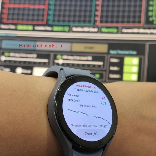  اندازه گیری HRV با نرم افزار BioVR