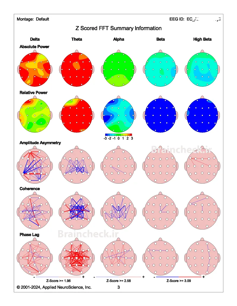 qEEG Analysis z-score summery info