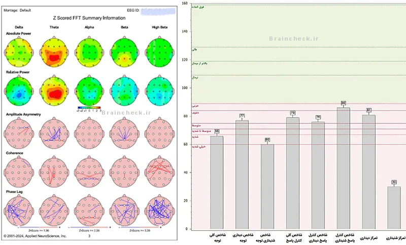 نتایج نقشه مغزی و تست توجه مراجع 10 ساله، قبل از شروع درمان نوروفیدبک