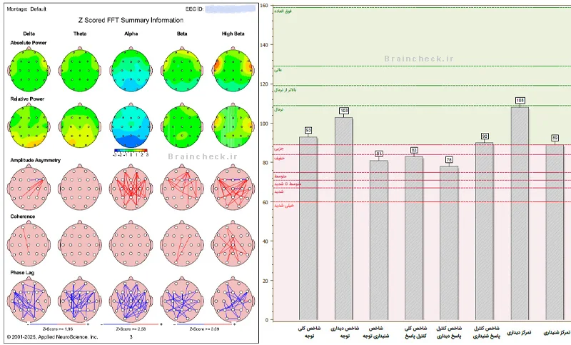 نتایج نقشه مغزی و تست توجه مراجع 10 ساله، پس از 15 جلسه درمان نوروفیدبک