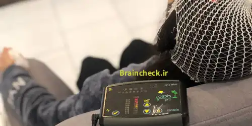  درمان غیرداردویی استرس و اضطراب با تحریک الکتریکی مغز tDCS