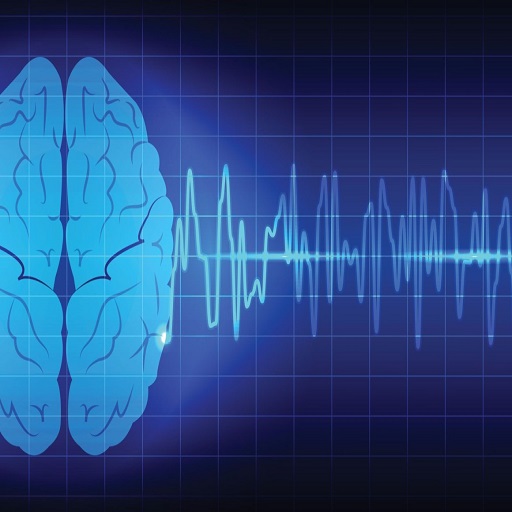 درباره امواج مغزی Brain Wave بیشتر بدانیم